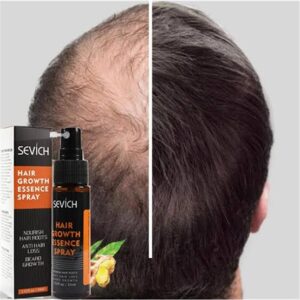Hair Growth Spray