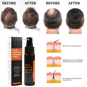 Hair Growth Spray