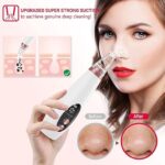 Rechargeable Electric Blackhead Remover Device