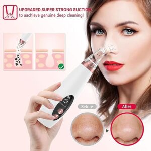 Rechargeable Electric Blackhead Remover Device